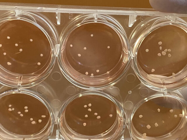 Scientists grow miniature brains that mimic the major pathological features of Parkinson's disease