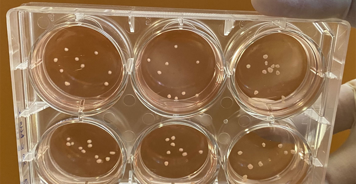 Scientists grow miniature brains that mimic the major pathological features of Parkinson's disease
