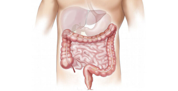 Colonoscopy