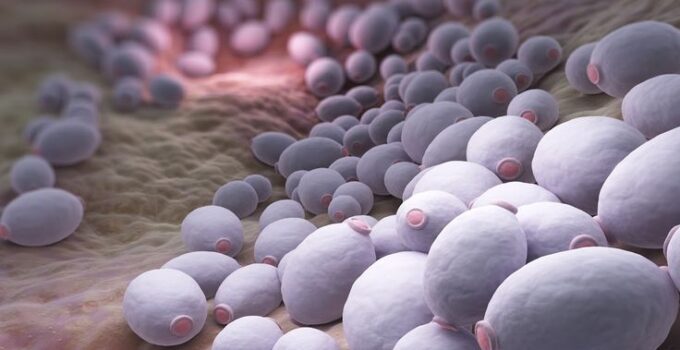 Candida