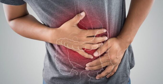 the ability of gastric cancers to resist chemotherapy