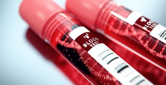New predictions for multi-cancer early detection via microsatellite instability (MSI) testing