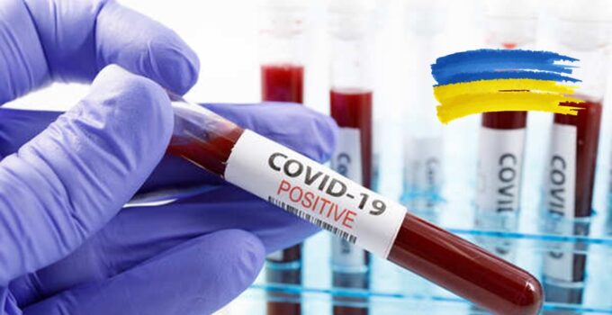 COVID-19 biospecimens for research