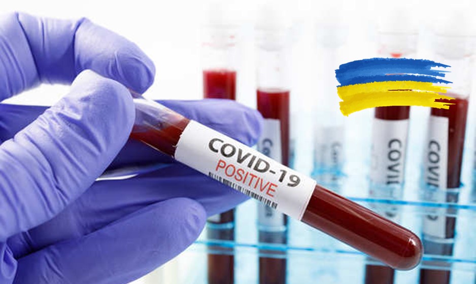 COVID-19 biospecimens for research