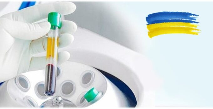Plasma samples for your research by BIOMEDICA CRO - human biospecimens provider