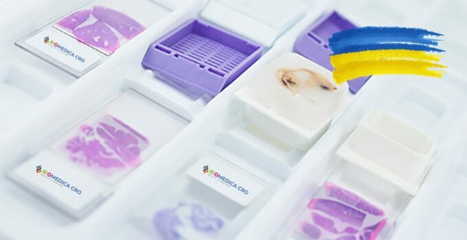 BIOMEDICA CRO provides scientists with diseased and normal blood, serum, plasma, tissues, urine samples, and other biofluids all over the world since 2017. We have a good collection rate of oncology samples (Bladder cancer, Breast cancer, CRC, Prostate cancer, etc.) and also access to specimens from other disease areas.