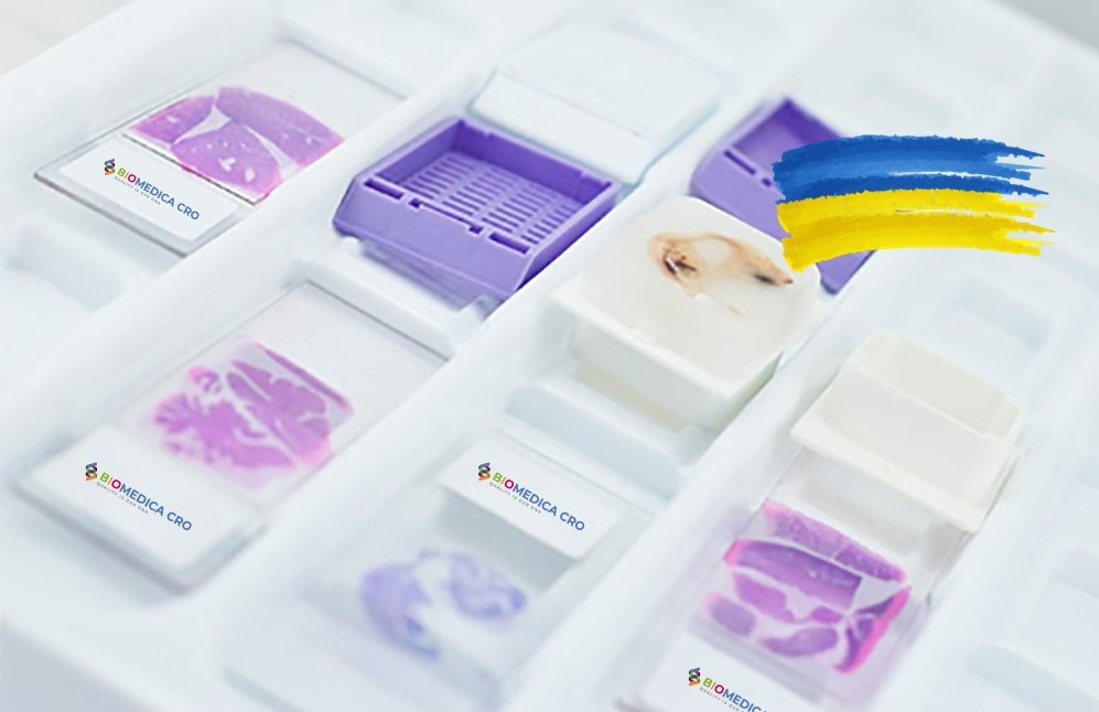 BIOMEDICA CRO provides scientists with diseased and normal blood, serum, plasma, tissues, urine samples, and other biofluids all over the world since 2017. We have a good collection rate of oncology samples (Bladder cancer, Breast cancer, CRC, Prostate cancer, etc.) and also access to specimens from other disease areas.