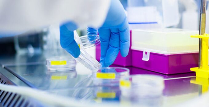 Samples collection from donors with various diseases by biospecimens company BIOMEDICA CRO