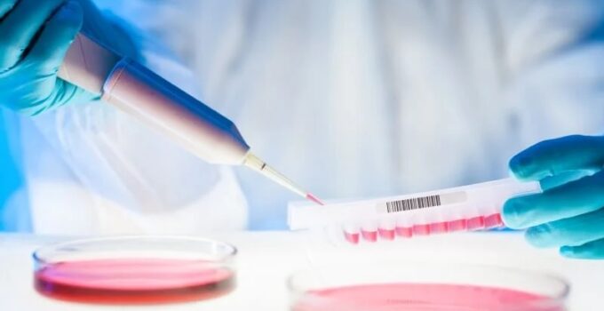 BIOMEDICA CRO – place request for human blood samples collection for your research