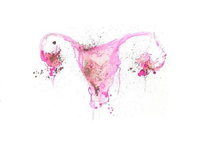 Endometriosis tissue samples, swabs and other biofluid samples collection by BIOMEDICA CRO – a trusted biospecimens provider since 2017