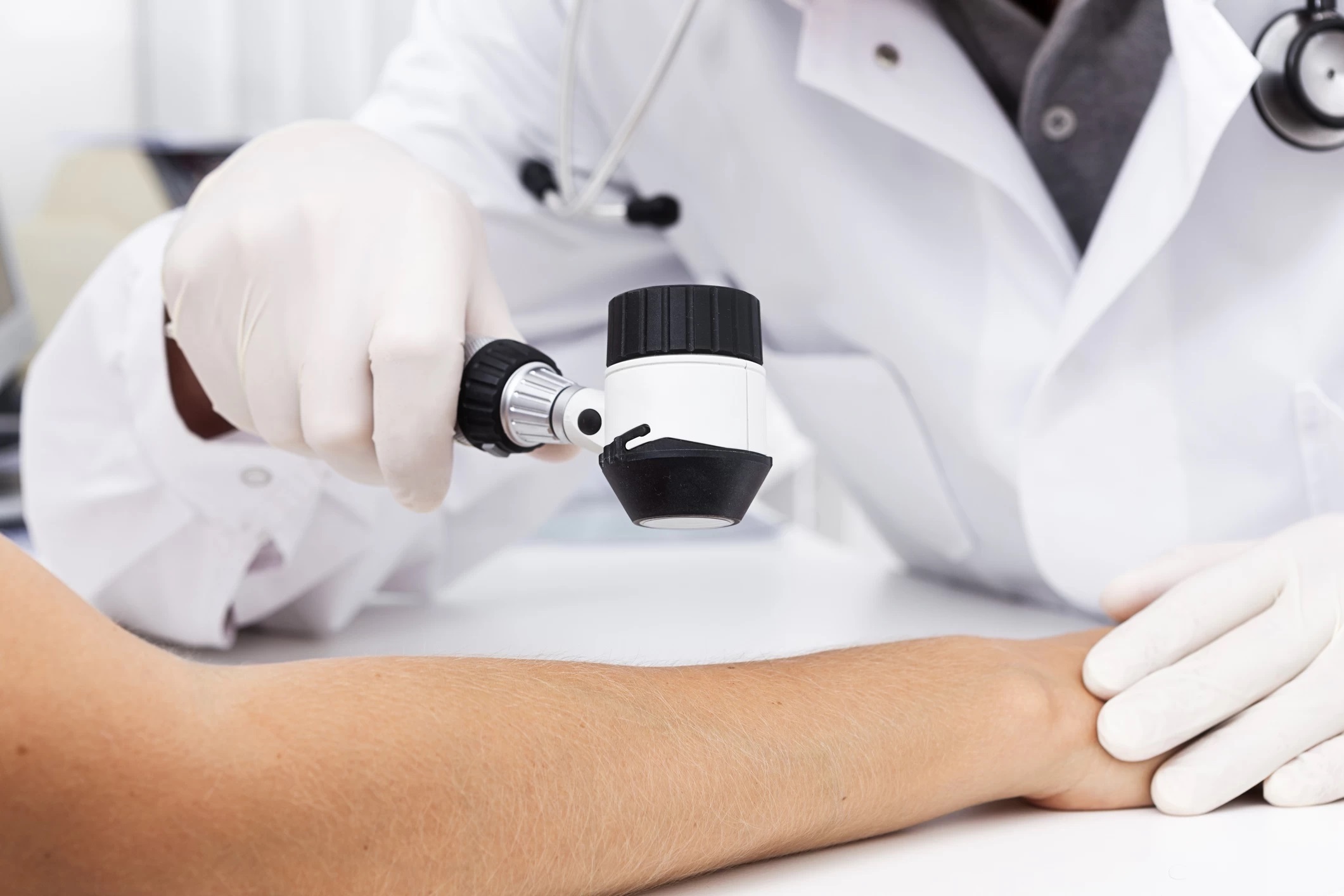 Order biospecimens for Psoriasis research. BIOMEDICA CRO has provided prospective and retrospective collections of the numerous human biosample types and associated clinical data since 2017.